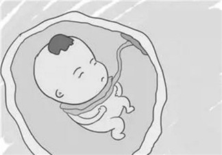 宝宝脐带绕颈是什么原因 脐带绕颈对宝宝都有哪些危害