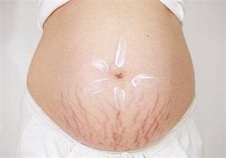 长妊娠纹用什么妊娠纹霜好 妊娠纹霜测评推荐