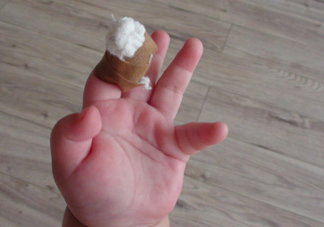 宝宝手指头划伤了怎么办 孩子手指头划伤处理方法