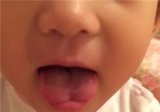 婴儿舌尖正常该是什么形状 为什么宝宝舌尖是w形状